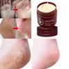 Juanita's Supply Company Anti-Fungal Foot Repair Cream Ultimate Solution Healthy Feet Dead Skin Removal Peeling Moisturizing Exfoliation Foot Care Repair For Cracked Heels Natural Organic Moisturizer view 4