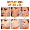 Gqrum  and  Removing Essence, 30ml Magic   Cream, Civetocat Vitamin C Solution, Remover  Essence For Face (2 Pcs) view 3