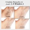 Blex Laser Hair Removal for Women and Men, IPL Hair Removal Device Effective in 2 Weeks, with Ultra-Fast 0.2s Light Emission, Comfortable and Painless, Black view 2
