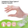 BEZOX Ingrown Toenail Corrector Set with Toenails Clipper for Thick Nails - 40 Pcs Pain-Free Toenail Straightener Strips with Toenail Lifter - Easy Use Ingrown Toenail Tools Kit view 4