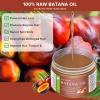 Goanpebl Raw Batana Oil for Hair Growth, Dr. Sebi Oil From Honduras Promotes Thickness, Repairs, Nourishes & Strengthens Moisturizing Scalp & Hair Mask for Men & Women 4.2 oz view 2