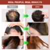 Goanpebl Raw Batana Oil for Hair Growth, Dr. Sebi Oil From Honduras Promotes Thickness, Repairs, Nourishes & Strengthens Moisturizing Scalp & Hair Mask for Men & Women 4.2 oz view 3