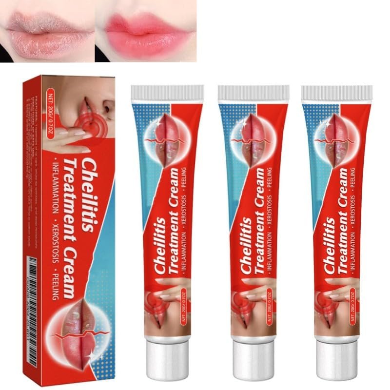 BEROZA Lip Lightening Cream, 20g Lip Balm Moisturizing, Lightening balm for Men and Women, 3pcs
