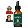Dark circles, Dark Under Eye Serum, Dark Circles Eraser serum 0.5 FL OZ view 1
