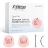 Reieset Titanium Alloy Ingrown Toenail Treatment, Nail Tools, and Ingrown Toenail Removal Kit Specially Designed for Curved Nail Repair and Ingrown Toenail Corrector (0.59/0.67in) view 1