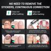 Reieset Titanium Alloy Ingrown Toenail Treatment, Nail Tools, and Ingrown Toenail Removal Kit Specially Designed for Curved Nail Repair and Ingrown Toenail Corrector (0.59/0.67in) view 2