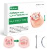 Reieset Titanium Alloy Ingrown Toenail Treatment, Nail Tools, and Ingrown Toenail Removal Kit Specially Designed for Curved Nail Repair and Ingrown Toenail Corrector (0.67/0.79in) view 1