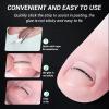 Reieset Titanium Alloy Ingrown Toenail Treatment, Nail Tools, and Ingrown Toenail Removal Kit Specially Designed for Curved Nail Repair and Ingrown Toenail Corrector (0.67/0.79in) view 4