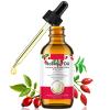 Rosehip Oil for Face, Rose Hip Oil Organic Rosehip Seed Oil 100% Pure Cold Pressed for Anti-Aging, Nourishing Hair Care, Face & Skin (2.02 Fl Oz) view 1
