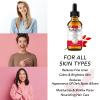 Rosehip Oil for Face, Rose Hip Oil Organic Rosehip Seed Oil 100% Pure Cold Pressed for Anti-Aging, Nourishing Hair Care, Face & Skin (2.02 Fl Oz) view 3