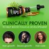 Follicle Booster Rosemary Oil Blend - Mint, Castor, Jojoba & Biotin added - Supports Hair Growth, Strengthens Follicles, Nourishes Scalp - For Adults & Teens - 3 Pack view 3