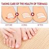 FUSSWIND German Toenail Plus Anti Paronychia Relief Oil, German 2024 New Toenailplus Anti Paronychia Relief Oil, Anti Paronychia Relief Oil for Toenail Care, Best Nail Repair Solution (5PCS) view 3
