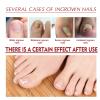 FUSSWIND German Toenail Plus Anti Paronychia Relief Oil, German 2024 New Toenailplus Anti Paronychia Relief Oil, Anti Paronychia Relief Oil for Toenail Care, Best Nail Repair Solution view 4