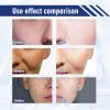 Achromin Cream, Achromin Skin Cream, Achromin Face Cream, Achromin Moisturizing Cream, For All Skin Type (1pcs) view 4