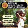 100% Raw Batana Oil  Unrefined from Honduras, Promotes Hair Growth, Thickness, and Prevents Hair Loss. Suitable for Both Men and Women. A Natural Hair Growth Oil - 4.05 fl.oz view 2