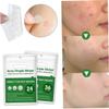 Acne Patches Invisible Makeup Absorbent Acne Patch Spot Pimple Absorbing Hydrocolloid Stickers Acne Cover Face Care Patch 36PCS. view 3