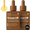 Keyoma Batana Oil for Hair Growth with Rosemary: Nourish & Detox Scalp for Thicker, Stronger, Longer Hair - 100% Organic Batana Oil from Honduras - Reduce Hair Loss (60 mL) view 1