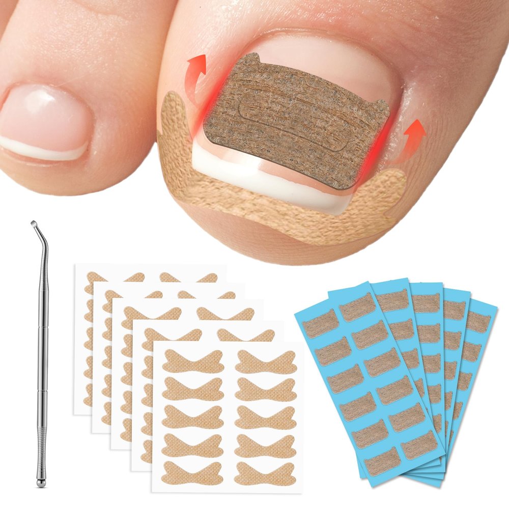 FVION Ingrown Toenail Corrector Set - 41 Pcs Pain-Free Ingrown Toenail Straightener Strips with Toenail Lifter - Effective Solution Ingrown Toenail Tools Kit