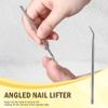 FVION Ingrown Toenail Corrector Set - 41 Pcs Pain-Free Ingrown Toenail Straightener Strips with Toenail Lifter - Effective Solution Ingrown Toenail Tools Kit view 3