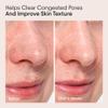 ALPYN Clarifying Facial Oil with Retinol & Pink Algae | Clear Congestion, Smooth Fine Lines, Improve Texture & Glow | 1 Fl Oz / 30 ml view 4