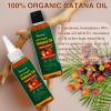 2 Pack Batana Oil Organic for Hair Growth, Botana Oil Hair Growth Rosemary Oil Vitamin E Blend Massager Boosting Hair Thickness, Nourish Scalp Hair, 6.76 fl.oz view 2