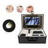 iumLeap Skin Follicle Detector, 9 Inch LCD Skin and Hair Analyzer Detector, Magnifier Skin Hair Blackhead Scalp Detector, for Skin, Hair Blackhead Follicle Scalp Detector view 4