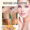 Bee Venom Repair Cream,Bee Venom Moisturizing and Nourishing Cream,Professional Bee Venom Repair Cream,Bee Venom Treatment Cream for All Parts of The Body,Suitable for All Skin Types of Men and Women view 4