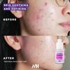 Handmade Heroes The Ultimate Bakuchiol Firming Face and Neck Lightweight Cream, Anti-Aging for Neck and Dcollet, Day & Night Face Cream - Moisturizing and Lifting view 2