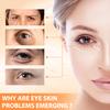 Tbexem Revive Glow Vitamin C Eye Balm, Hydrating Eye Cream,Improve Dark Circles,Brightens Skin Tone,Reduces Puffiness(2PCS) view 2