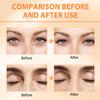Tbexem Revive Glow Vitamin C Eye Balm, Hydrating Eye Cream,Improve Dark Circles,Brightens Skin Tone,Reduces Puffiness(2PCS) view 4