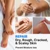 Urea Cream 40%, Keratolytic Foot Cream for Dry Cracked Heels, Feet, Knees, Elbows, Hands, Cuticle, Callus Remover, Skin Barrier Repair (3) view 2