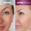 Retinol Eye Gel - Reduces Puffiness & Dark Circles, Restores Elasticity 6X Super Serum  Unique, Intensive Formula Accelerates Skin Renewal While You Sleep. view 3