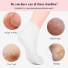 Silicone Socks for Women - 2 Pair Moisturizing Socks for Foot Care | Up to Size 10 - Silicone Foot Socks for Dry Cracked Feet view 2