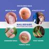 Nail Repair Liquid Solution for Thick Broken Discolored & Damaged Toenail and Fingernails view 2