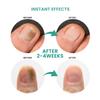 Nail Repair Liquid Solution for Thick Broken Discolored & Damaged Toenail and Fingernails view 4