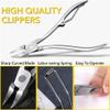 ZUIAI Professional Toenail Clippers Correction Thick Nails Ingrown Paronychia Trimmer Edge Cutter Manicure Scissor Pedicure Tool view 3