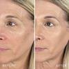 Doll Skin Genius Serum Concealer with Reishi Mushroom (Fair/Light, One Size) view 4