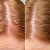 Healthy Scalp Exfoliating Treatment 100ml, Pre-Wash Scalp Exfoliant view 4