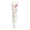 MAKARI Acne Control Spot Solution (1.35 fl oz) Vegan Formula view 1