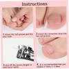 50PCS Ingrown Toenail Correction Strip Brace Kit Toenail Corrector Straightener Strip for Foot Care Tool view 3