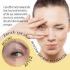 Eye Roller for Puffy Eyes, Castor Oil and Frankincense Eye Roller for Dark Circles, and Wrinkles, Anti Aging Eye Serum Cream, Glass Bottle, 2 PCS view 2