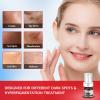 Dark Spot Remover for Face and Body - Dark Spot Corrector Serum for Acne Scars, Melasma, Age, Sun, Black Spots | Advanced Formula for Women and Men |Suitable for Oily, Dry and Combination Skin, 1.35FL view 2