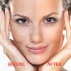 Dark Spot Remover for Face and Body - Dark Spot Corrector Serum for Acne Scars, Melasma, Age, Sun, Black Spots | Advanced Formula for Women and Men |Suitable for Oily, Dry and Combination Skin, 1.35FL view 3