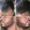 Beard Pen Filler for Men - Barber Styling Grooming Pencil - Waterproof, Sweat Proof, Long Lasting Solution with Natural Finish - Cover Beard and Scalp Patches in Seconds - Medium Brown 5 Pack view 2