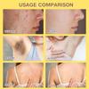 Bee Venom Treatment Cream, 2025 New Professional Bee Venom Repair Cream, For All Body Parts(2 Bottles) view 4