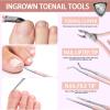 Teenitor Ingrown Toenail Tool, Pedicure Tools for Feet, Surgical Stainless Steel Ingrown Toenail Removal Kit, Ingrown Toenail Treatment, Ingrown Toenail Clippers, Ingrown Toenail File and Lifters view 3