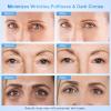 Dongyu Anti-Aging Eye Cream for Wrinkles: Under Eye Cream with Snail Mucin Caffeine for Fine Lines Puffiness - Firming Eye Serum for Women view 3