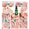 Ginger Nail Treatment Nail Support Nail Care, 7days Nail Treatment, Ginger Nail Growth Serum, Ginger Cuticle Care Oil for Nails,Cuticle Serum for Nails (3Pcs, 1 Fl.oz(pack of 1)) view 2