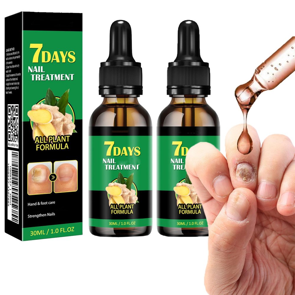 Ginger Nail Treatment Nail Support Nail Care, 7days Nail Treatment, Ginger Nail Growth Serum, Ginger Cuticle Care Oil for Nails,Cuticle Serum for Nails (2Pcs, 1 Fl.oz(pack of 1))