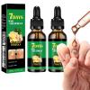 Ginger Nail Treatment Nail Support Nail Care, 7days Nail Treatment, Ginger Nail Growth Serum, Ginger Cuticle Care Oil for Nails,Cuticle Serum for Nails (2Pcs, 1 Fl.oz(pack of 1)) view 1